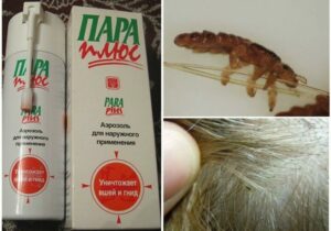 Пара Плюс: аэрозоль и шампунь с инструкций по применению