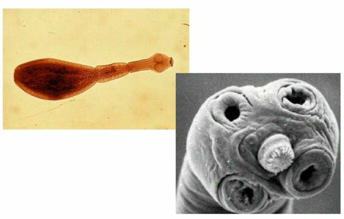 Карликовый цепень: симптомы появления и лечение геминолепидоза